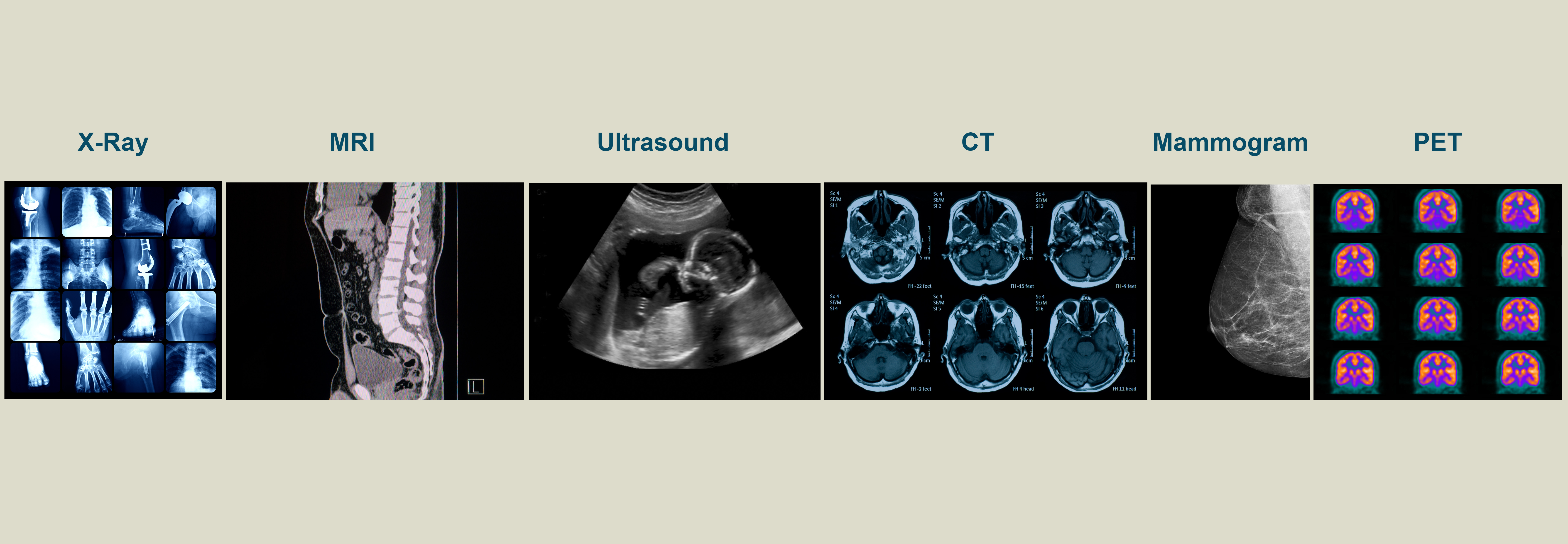 Illustrative Image shows examples of imaging scans.