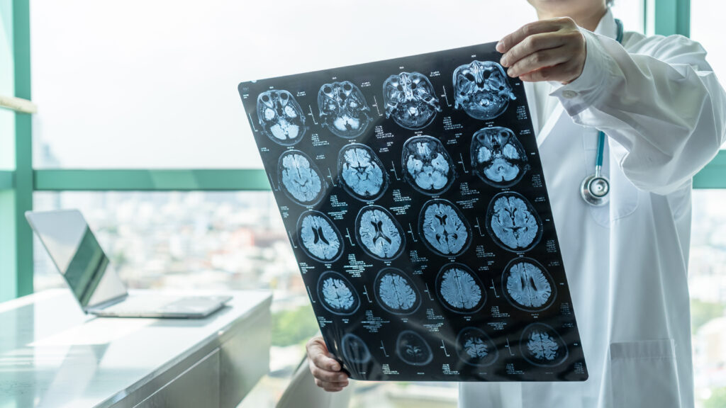Neuro Stock Image
